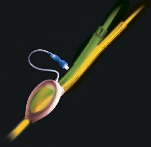 ML - ProSeal - ventilação e drenagem